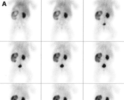 Renal imaging in nuclear medicine .